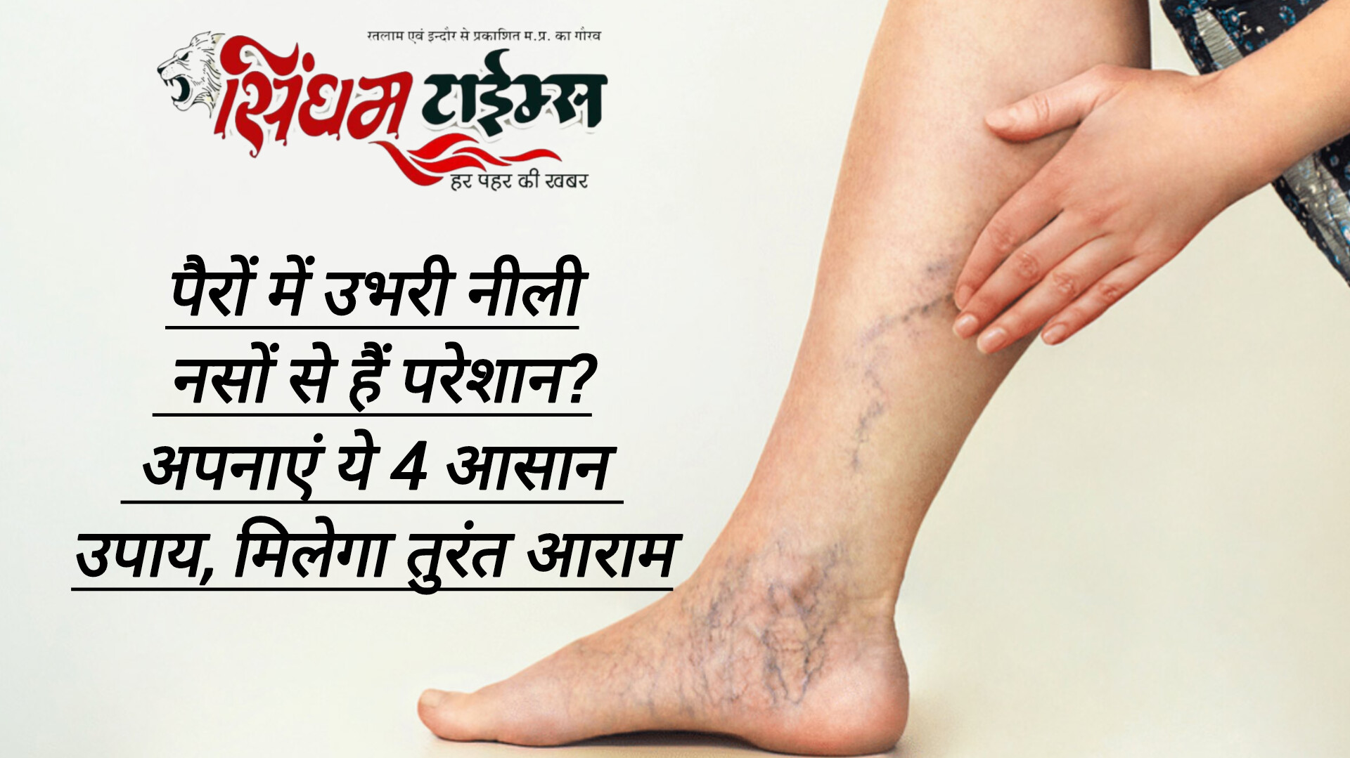 पैरों में उभरी नीली नसों से हैं परेशान? अपनाएं ये 4 आसान उपाय, मिलेगा तुरंत आराम