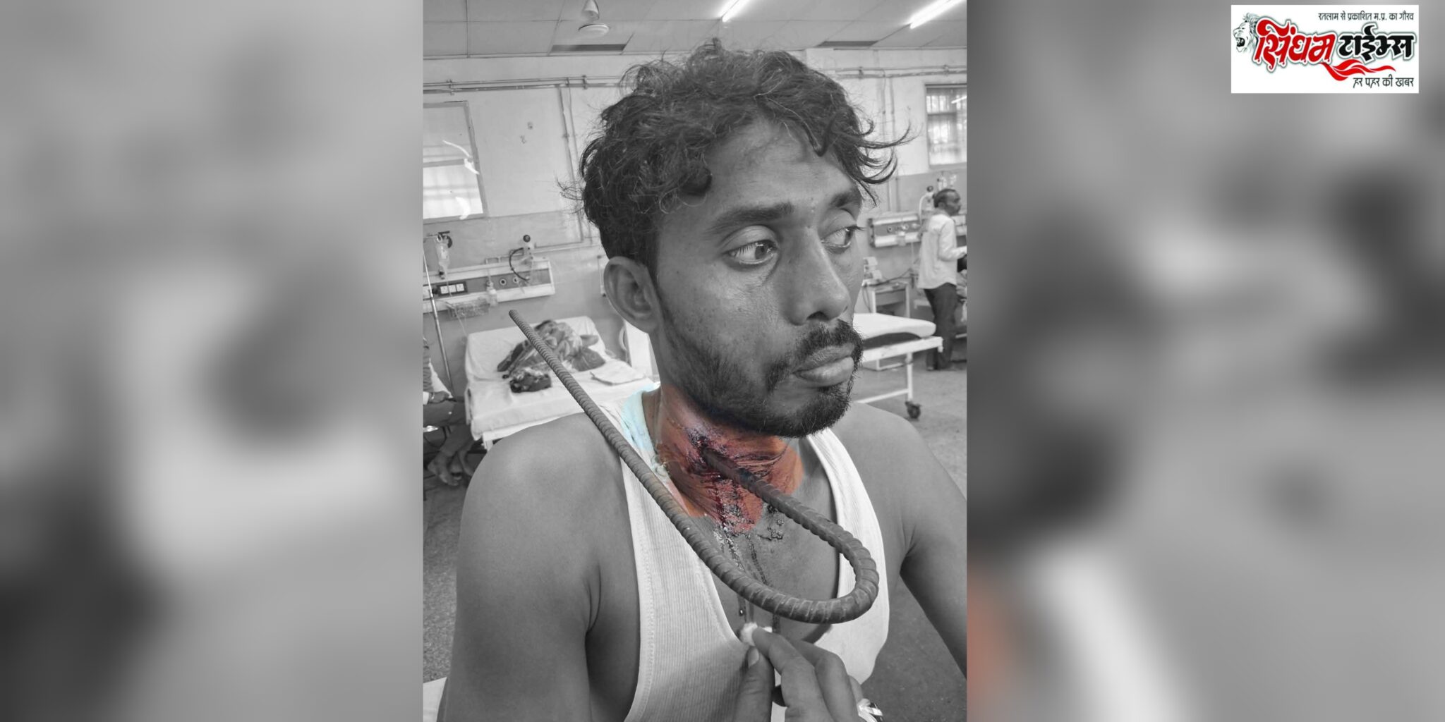 लोहे का सरिया गले में घुसने के बावजूद युवक की बच गई जान, एमवाय अस्पताल में सफल ऑपरेशन